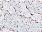 3635A | Control Slides:Immunopathology; p40